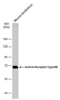 Western Blot: Activin RIIB Antibody [NBP2-15268]