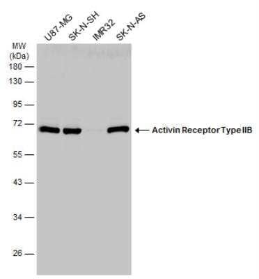 Western Blot: Activin RIIB Antibody [NBP2-15268]