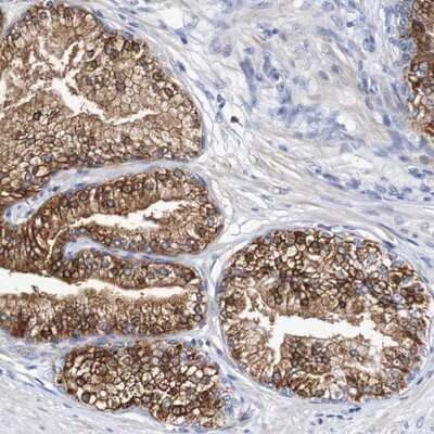 Immunohistochemistry-Paraffin: ALK-7/Activin Receptor Type 1C Antibody [NBP1-90252]