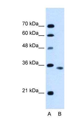 Western Blot: Activin RIIB Antibody [NBP1-59708]