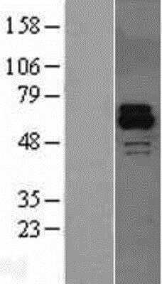 Western Blot: Activin RIIB Overexpression Lysate [NBL1-07297]