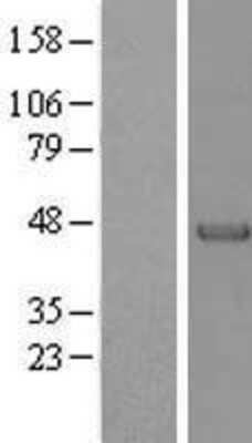 Western Blot: Alpha-parvin/Actopaxin Overexpression Lysate [NBL1-14120]