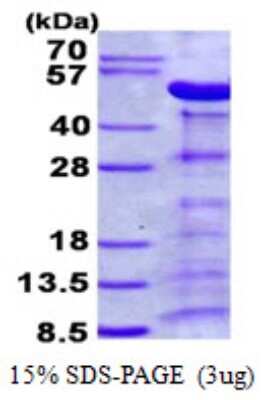 SDS-PAGE: Recombinant Human Alpha-parvin/Actopaxin His Protein [NBP2-23317]