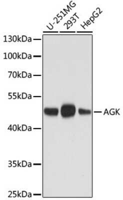 Western Blot: Acylglycerol Kinase Antibody (9A3B1)Azide and BSA Free [NBP3-05339]