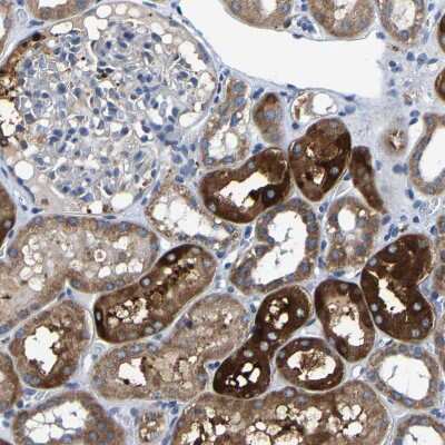 Immunohistochemistry-Paraffin: Acylglycerol Kinase Antibody [NBP1-83825]