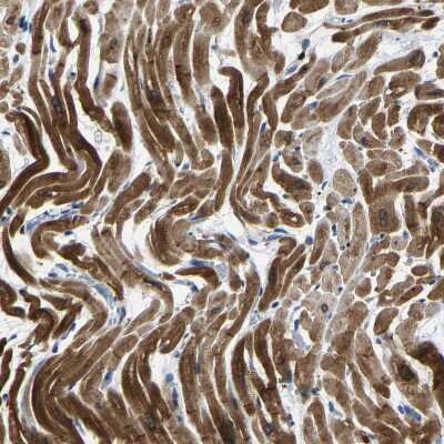 Immunohistochemistry-Paraffin: Acylglycerol Kinase Antibody [NBP1-83825]