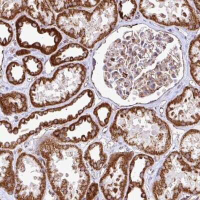 Immunohistochemistry-Paraffin: Acylglycerol Kinase Antibody [NBP2-49085]