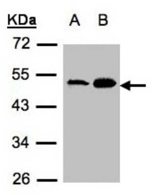 Western Blot: Acylglycerol Kinase Antibody [NBP1-32163]