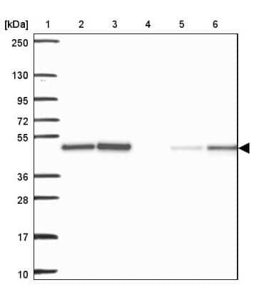 Western Blot: Acylglycerol Kinase Antibody [NBP2-49085]