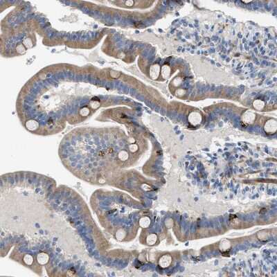 Immunohistochemistry: Acyloxyacyl Hydrolase Antibody [NBP2-33892]