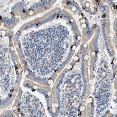 Immunohistochemistry-Paraffin: Acyloxyacyl Hydrolase Antibody [NBP2-33892]