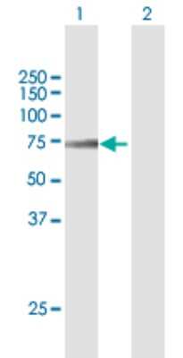 Western Blot: Acyloxyacyl Hydrolase Antibody [H00000313-B01P]