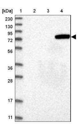 Western Blot: Acyloxyacyl Hydrolase Antibody [NBP2-33892]