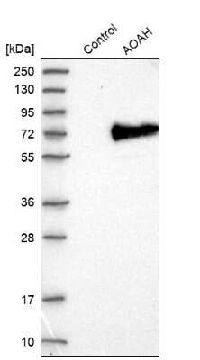 Western Blot: Acyloxyacyl Hydrolase Antibody [NBP2-33905]