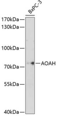 Western Blot: Acyloxyacyl Hydrolase AntibodyBSA Free [NBP2-92016]