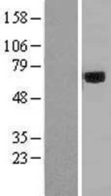 Western Blot: Acyloxyacyl Hydrolase Overexpression Lysate [NBL1-07569]