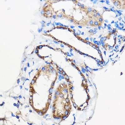 Immunohistochemistry-Paraffin: Adenine Nucleotide Translocase 1/2/3/4 Antibody - Azide and BSA Free [NBP3-05640]