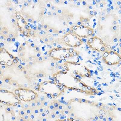 Immunohistochemistry-Paraffin: Adenine Nucleotide Translocase 1/2/3/4 Antibody - Azide and BSA Free [NBP3-05640]