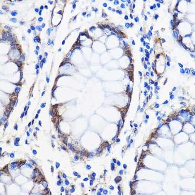Immunohistochemistry-Paraffin: Adenine Nucleotide Translocase 1/2/3/4 Antibody - Azide and BSA Free [NBP3-05640]
