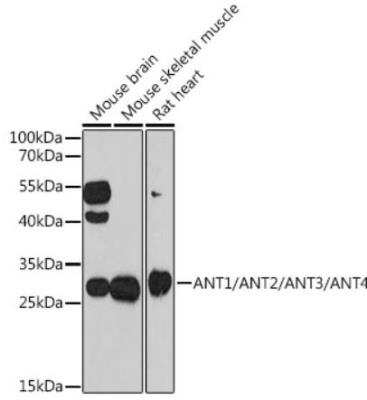 Western Blot: Adenine Nucleotide Translocase 1/2/3/4 AntibodyAzide and BSA Free [NBP3-05640]