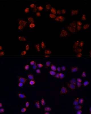 Immunocytochemistry/ Immunofluorescence: Adenine Nucleotide Translocase 1 Antibody - Azide and BSA Free [NBP2-92626]