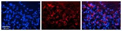 Immunohistochemistry: Adenine Nucleotide Translocase 1 Antibody [NBP1-59594]