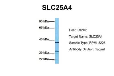 Western Blot: Adenine Nucleotide Translocase 1 Antibody [NBP1-59594]