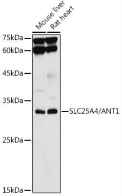 Western Blot: Adenine Nucleotide Translocase 1 AntibodyAzide and BSA Free [NBP2-92642]