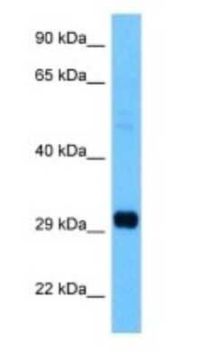 Western Blot: Adenine Nucleotide Translocase 1 Antibody [NBP3-10974]