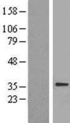 Western Blot: Adenine Nucleotide Translocase 1 Overexpression Lysate [NBL1-16067]