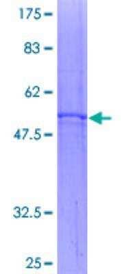 SDS-PAGE: Recombinant Human Adenine Nucleotide Translocase 1 GST (N-Term) Protein [H00000291-P01]