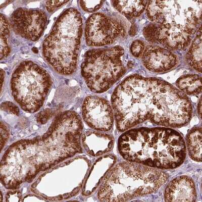 Immunohistochemistry-Paraffin: Adenine Nucleotide Translocator 2 Antibody [NBP2-57642]