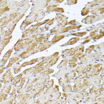 Immunohistochemistry-Paraffin: Adenine Nucleotide Translocator 2 Antibody - Azide and BSA Free [NBP2-92630]