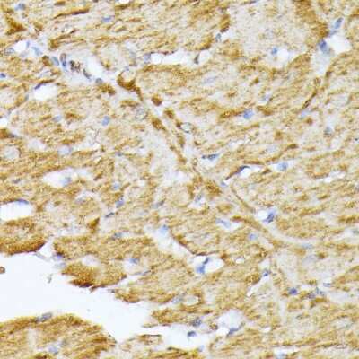 Immunohistochemistry-Paraffin: Adenine Nucleotide Translocator 2 Antibody - Azide and BSA Free [NBP2-92630]