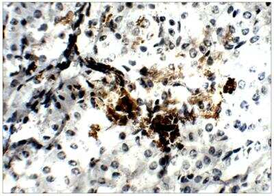 Immunohistochemistry-Paraffin: Adenine Nucleotide Translocator 2 Antibody [NBP3-12220]