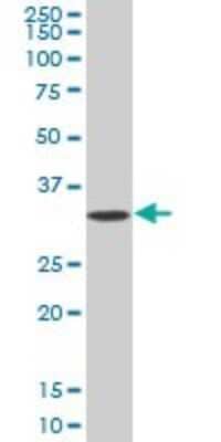 Western Blot: Adenine Nucleotide Translocator 2 Antibody [H00000292-B01P]