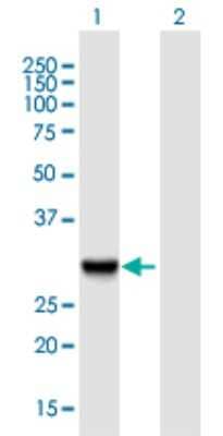 Western Blot: Adenine Nucleotide Translocator 2 Antibody [H00000292-B01P]