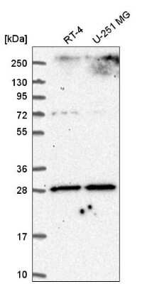 Western Blot: Adenine Nucleotide Translocator 2 Antibody [NBP2-56762]