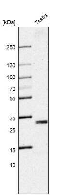 Western Blot: Adenine Nucleotide Translocator 2 Antibody [NBP2-56762]