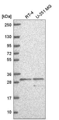 Western Blot: Adenine Nucleotide Translocator 2 Antibody [NBP2-57642]