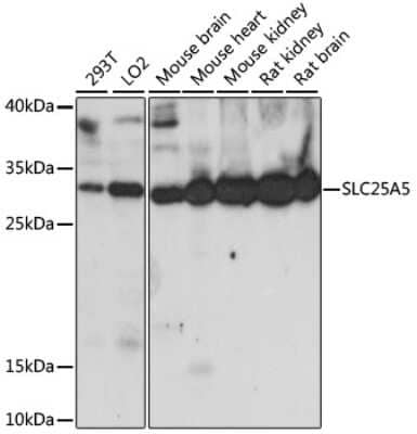 Western Blot: Adenine Nucleotide Translocator 2 AntibodyAzide and BSA Free [NBP2-92630]