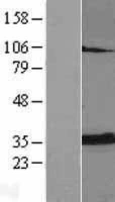 Western Blot: Adenine Nucleotide Translocator 2 Overexpression Lysate [NBL1-16073]