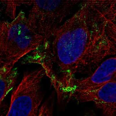 Immunocytochemistry/ Immunofluorescence: Adenosine A1R Antibody [NBP2-58443]