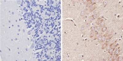 Immunohistochemistry-Paraffin: Adenosine A1R Antibody - BSA Free [NB300-549]