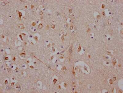 Immunohistochemistry: Adenosine A1R Antibody (10D12) [NBP3-15218]