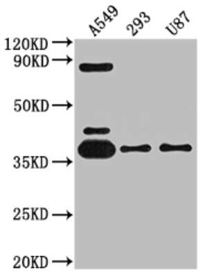 Western Blot: Adenosine A1R Antibody (10D12) [NBP3-15218]