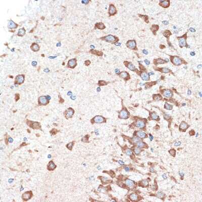 Immunohistochemistry-Paraffin: Adenosine A1R Antibody (8C3P3) [NBP3-16594]