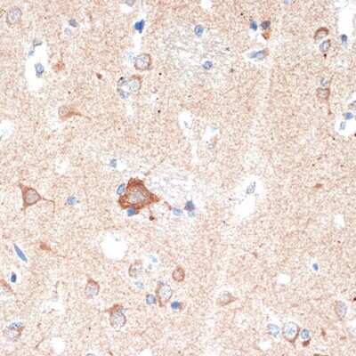Immunohistochemistry-Paraffin: Adenosine A1R Antibody (8C3P3) [NBP3-16594]