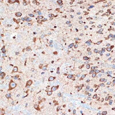Immunohistochemistry-Paraffin: Adenosine A1R Antibody (8C3P3) [NBP3-16594]
