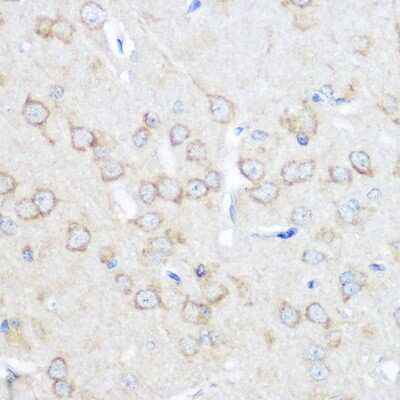 Immunohistochemistry-Paraffin: Adenosine A1R Antibody - Azide and BSA Free [NBP3-15570]